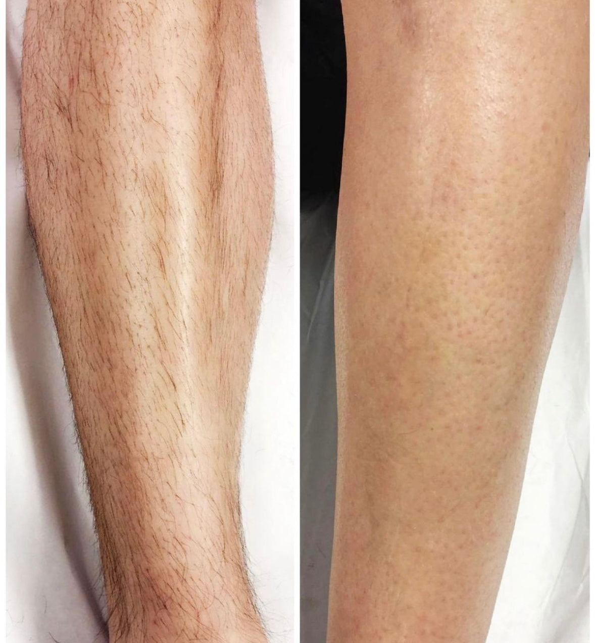 Pierre d’Épilation Nano – Exfoliation & Élimination des Poils Sans Douleur - Terre sublime 