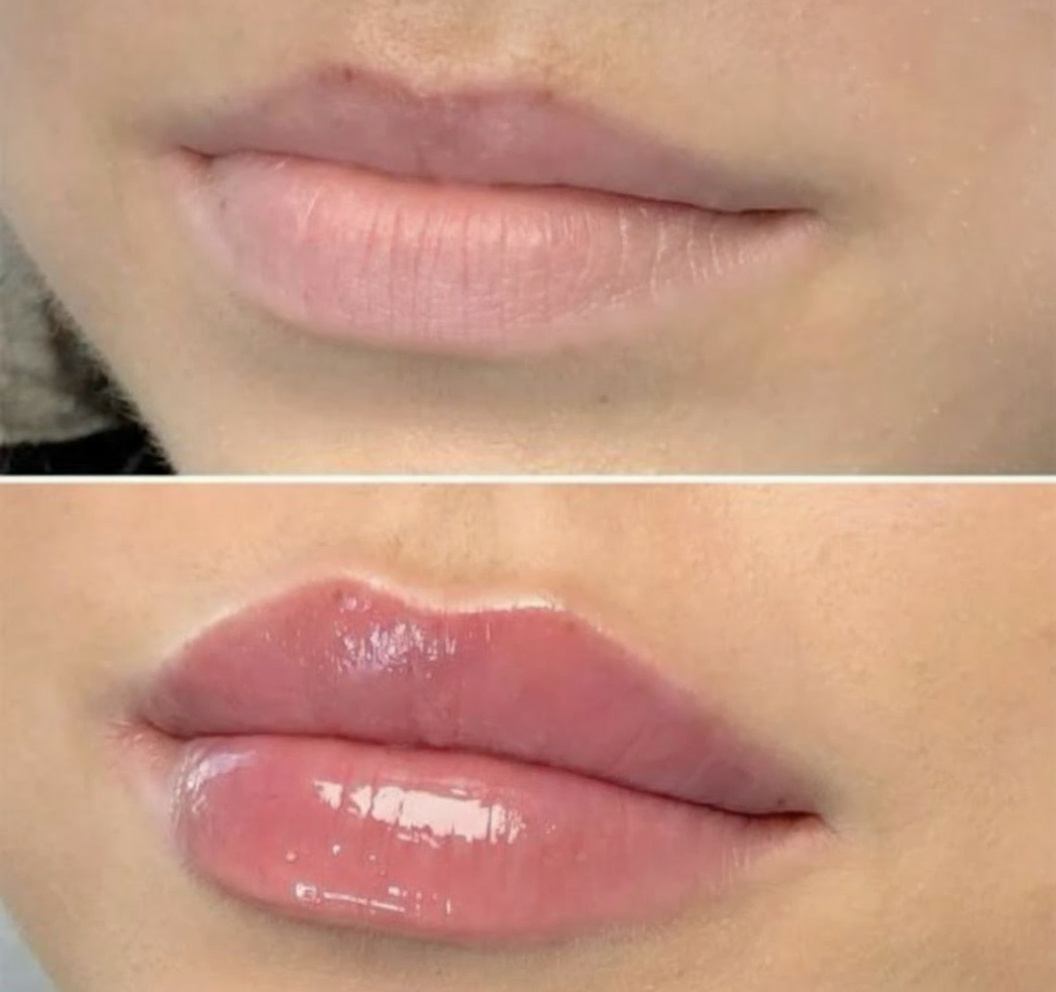 Sérum Repulpant Lèvres 17 ml – Volume Instantané & Hydratation Longue Durée - Terre sublime 