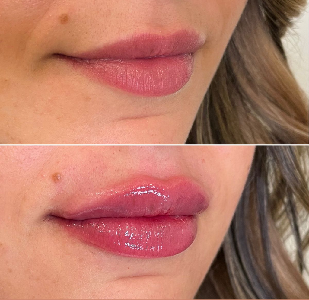 Sérum Repulpant Lèvres 17 ml – Volume Instantané & Hydratation Longue Durée - Terre sublime 